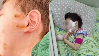 Пятилетний Батыр боится лифтов после жестокого нападения в Астане